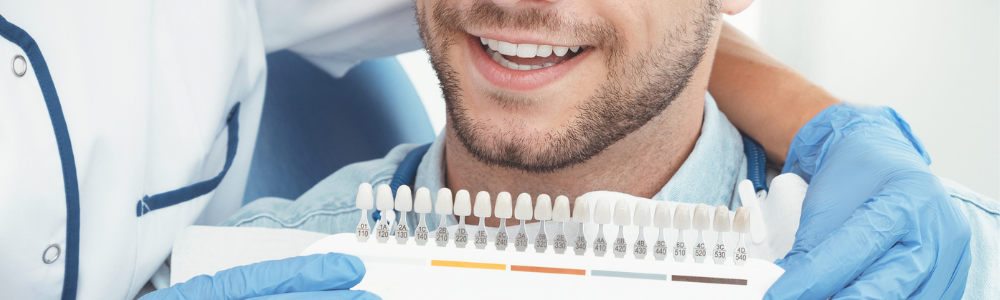Zähne bleachen in Starnberg - professionelle Zahnaufhellung vom Zahnarzt